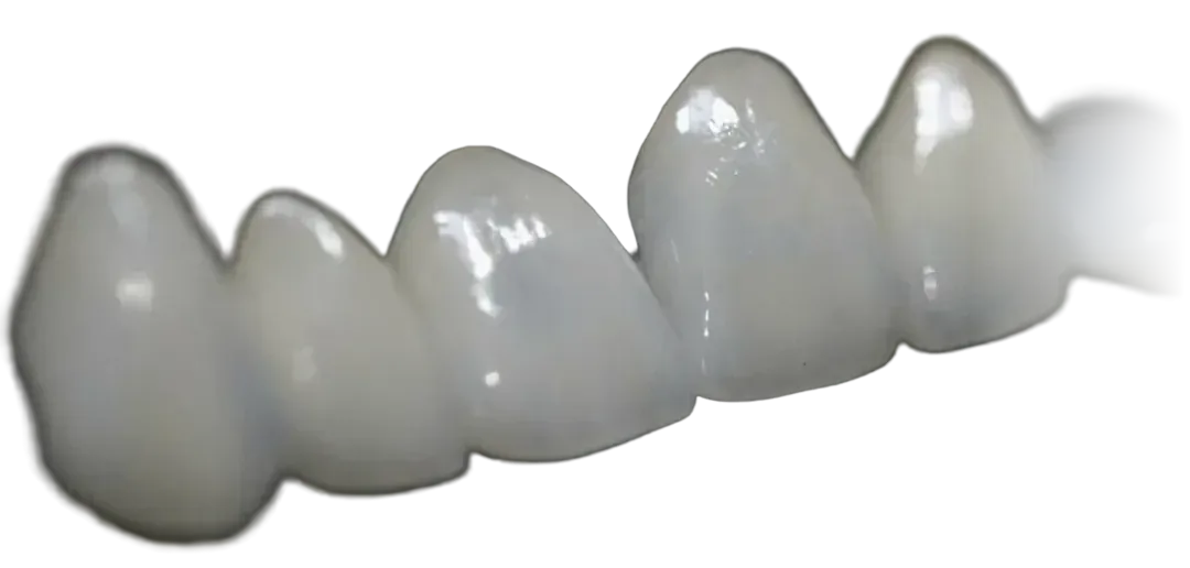 Fileira de facetas cerâmicas sobre fundo escuro